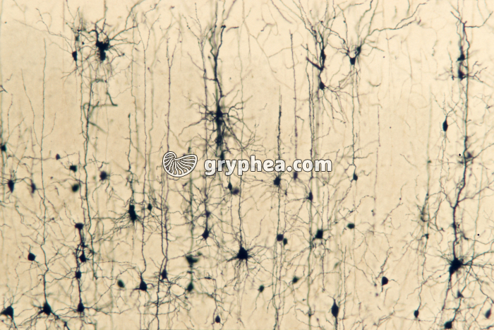 Neurones du cortex cérébral de Rat x25 - gryphea.com